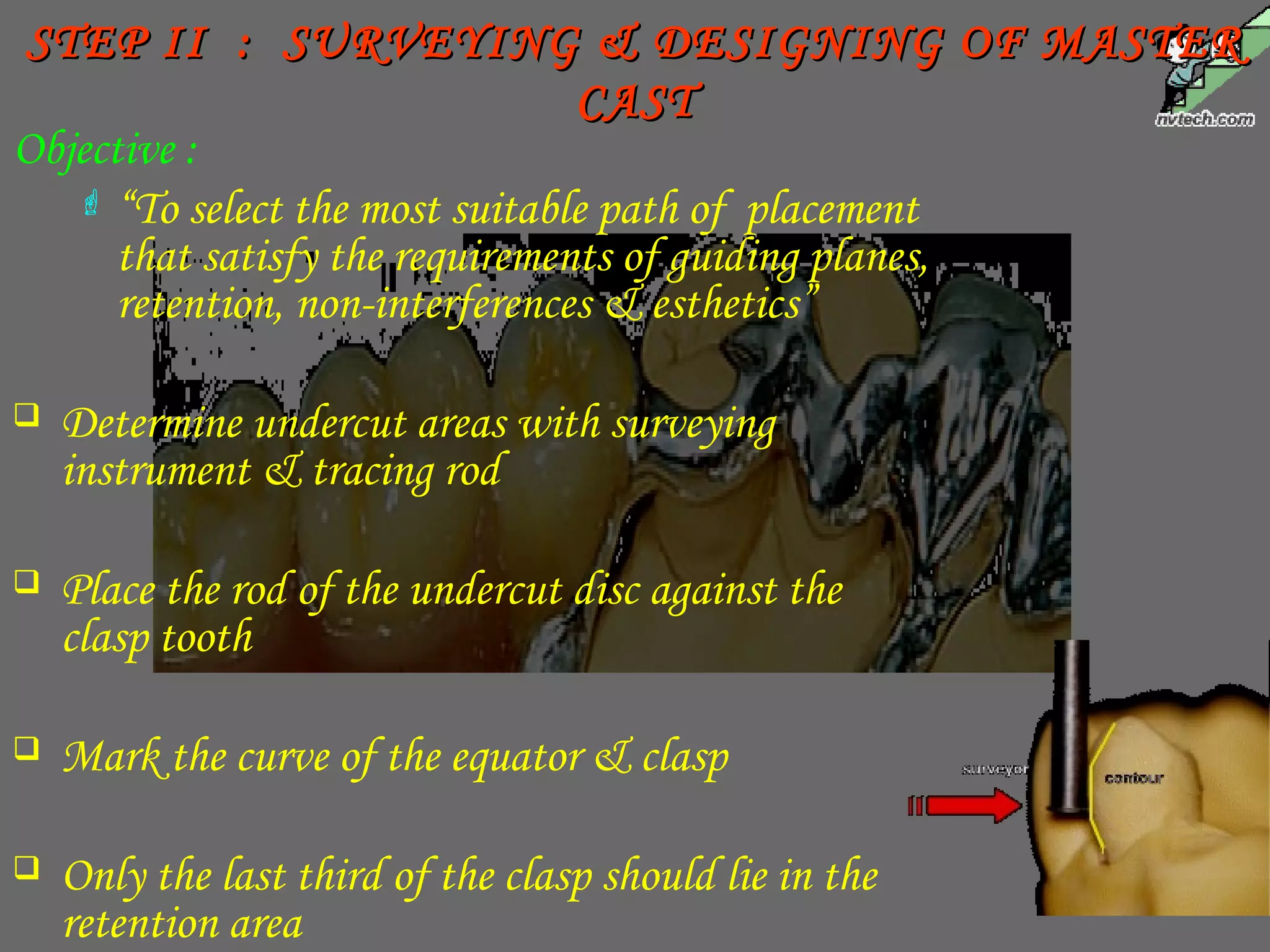 STEP II : SURVEYING & DESIGNING OF MASTERSTEP II : SURVEYING & DESIGNING OF MASTER
CASTCAST
Objective :
 “To select the most suitable path of placement
that satisfy the requirements of guiding planes,
retention, non-interferences & esthetics”
 Determine undercut areas with surveying
instrument & tracing rod
 Place the rod of the undercut disc against the
clasp tooth
 Mark the curve of the equator & clasp
 Only the last third of the clasp should lie in the
retention area
 