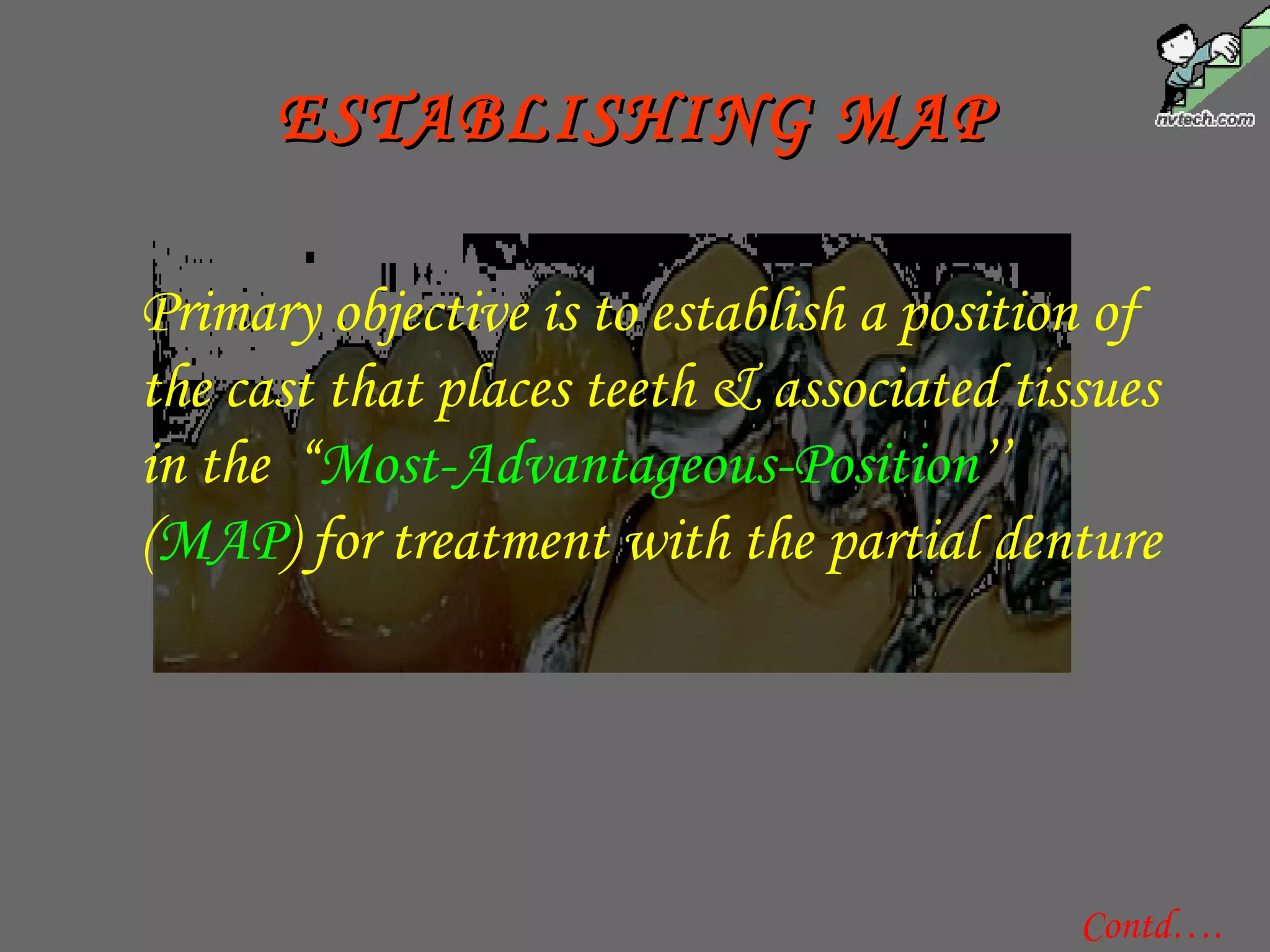 Contd….
ESTABLISHING MAPESTABLISHING MAP
Primary objective is to establish a position of
the cast that places teeth & associated tissues
in the “Most-Advantageous-Position’’
(MAP) for treatment with the partial denture
 