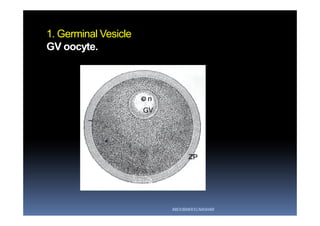 1. Germinal Vesicle
GV oocyte.
ABOUBAKR ELNASHAR
 