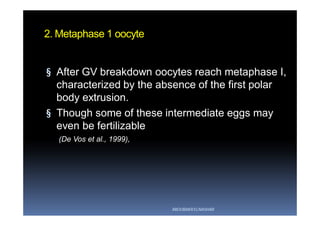 2. Metaphase 1 oocyte
§ After GV breakdown oocytes reach metaphase I,
characterized by the absence of the first polar
body extrusion.
§ Though some of these intermediate eggs may
even be fertilizable
(De Vos et al., 1999),
ABOUBAKR ELNASHAR
 