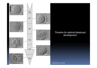 Timeline for optimal blastocyst
development.
ABOUBAKR ELNASHAR
 