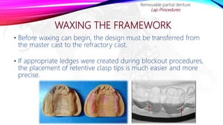 WAXING THE FRAMEWORK
• Before waxing can begin, the design must be transferred from
the master cast to the refractory cast.
• If appropriate ledges were created during blockout procedures,
the placement of retentive clasp tips is much easier and more
precise.
Removable partial denture
Lap Procedures
 