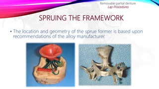 SPRUING THE FRAMEWORK
• The location and geometry of the sprue former is based upon
recommendations of the alloy manufacturer.
Removable partial denture
Lap Procedures
 