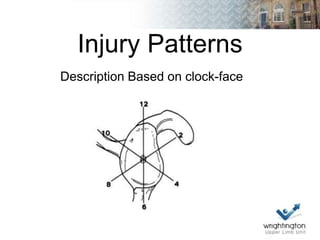 Labral injuries and traumatic instability | PPTX