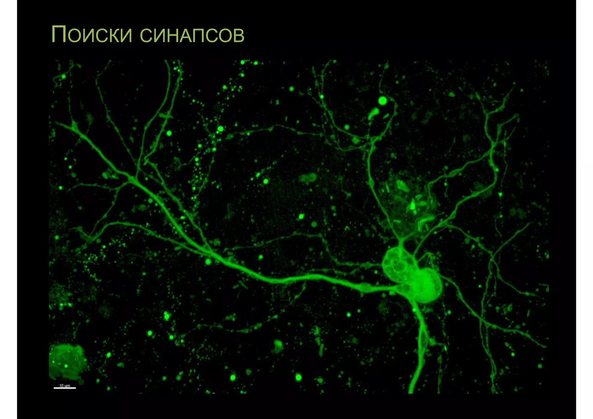 ПОИСКИ СИНАПСОВ
 
