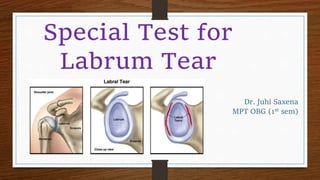 Dr. Juhi Saxena
MPT OBG (1st sem)
Special Test for
Labrum Tear