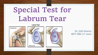 Dr. Juhi Saxena
MPT OBG (1st sem)
Special Test for
Labrum Tear
 