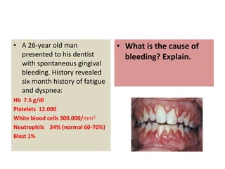 • A 26-year old man
presented to his dentist
with spontaneous gingival
bleeding. History revealed
six month history of fatigue
and dyspnea:
Hb 7.5 g/dl
Platelets 12.000
White blood cells 300.000/mm3
Neutrophils 34% (normal 60-70%)
Blast 1%
• What is the cause of
bleeding? Explain.
 
