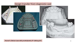Design transfer from diagnostic cast
9
Stewart’s clinical removable prosthodontics.4th edition.p314 10
 