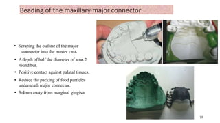 Beading of the maxillary major connector
• Scraping the outline of the major
connector into the master cast.
• Adepth of half the diameter of a no.2
round bur.
• Positive contact against palatal tissues.
• Reduce the packing of food particles
underneath major connector.
• 3-4mm away from marginal gingiva.
10
11
 