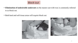 Block out
• Elimination of undesirable undercuts on the master cast with wax is commonly referred
to as block out.
• Both hard and soft tissue areas will require block out.
13
 