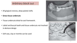Arbitrary block out
• All gingival crevices, deep palatal clefts
• Gross tissue undercuts
• Tissue undercuts distal to cast framework.
• Labial and buccal tooth and tissue undercuts not involved
in denture design
• Soft wax, clay or mortite can be used
17
 