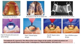 Grp A:Ribbon-sprue
design
Kennedy Class III Mod I
Grp D: Round with reservoir-
sprue design
Grp B: Square-sprue
design
Grp C: Round-sprue
design
Evaluation of the fit on master die
Viswambaran M, Agarwal S. The effect of four sprue shapes on the quality of cobalt-chromium cast
removable partial denture frame-works. Contemporary Clinical Dentistry. 2013;4(2):132.
Occlusal Radiograph showing internal defect
40
 