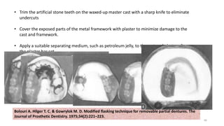 66
Bolouri A. Hilger T. C. & Gowrylok M. D. Modified flasking technique for removable partial dentures. The
Journal of Prosthetic Dentistry. 1975;34(2):221–223.
• Trim the artificial stone teeth on the waxed-up master cast with a sharp knife to eliminate
undercuts
• Cover the exposed parts of the metal framework with plaster to minimize damage to the
cast and framework.
• Apply a suitable separating medium, such as petroleum jelly, to the cast and plaster after
the plaster has set.
• Flask the prepared master cast, and boil out, pack, and cure in the conventional manner
 