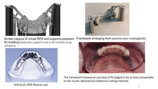 Screen capture of virtual RPD and supports prepared
for building (adequate supports had to be created using
software)
Framework emerging from selective laser melting(SLM).
SLM Co/Cr RPD fitted to cast.
The framework showed an accuracy of fit judged to be at least comparable
to the results obtained by traditional casting methods.
70
 