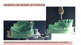 Kenneth D Rudd, Robert M morrowDental laboratory procedures- Removable partial denture vol 3; 2nd edition.
MARKING THE HEIGHT OF CONTOUR
9
9
 