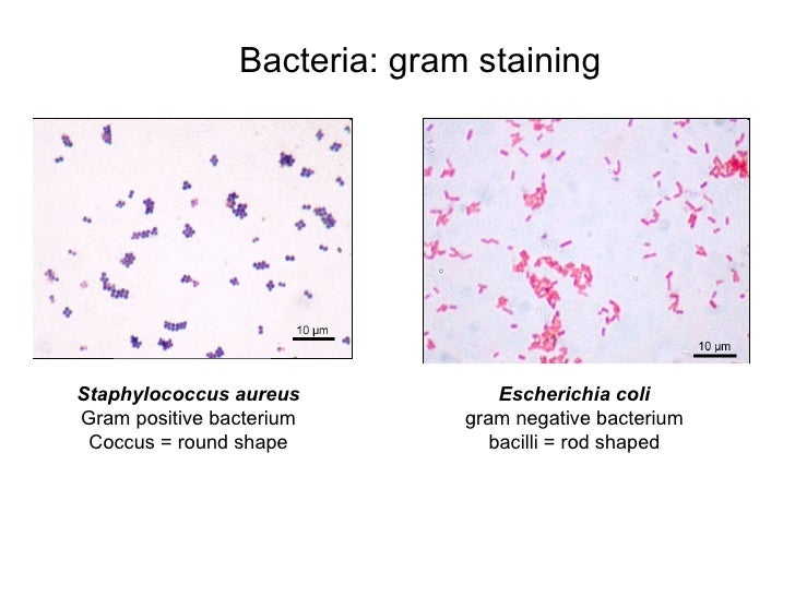lab report on staphylococcus aureus after acid fast staining In this specimen, the gram-positive bacterium staphylococcus aureus retains crystal violet dye even after the decolorizing agent is added acid-fast staining is another commonly used, differential staining technique that can be an additionally, this species has not been successfully cultured in the laboratory on an. lab report on staphylococcus aureus after acid fast staining In this specimen, the gram-positive bacterium staphylococcus aureus retains crystal violet dye even after the decolorizing agent is added acid-fast staining is another commonly used, differential staining technique that can be an additionally, this species has not been successfully cultured in the laboratory on an.