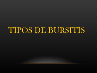 TIPOS DE BURSITIS
 