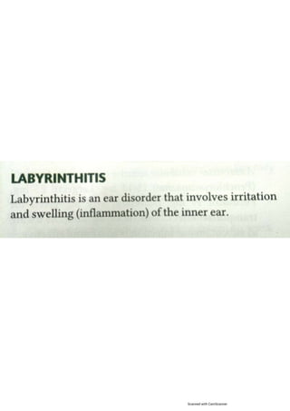 Labyrinthitis