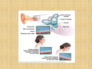 Labyrinthitis Tm Labyrinthitis | PPTX