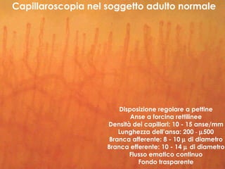 La capillaroscopia nell'artrite reumatoide | PPT
