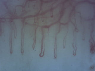 La capillaroscopia nell'artrite reumatoide | PPT