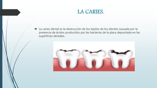 LA CARIES.
 La caries dental es la destrucción de los tejidos de los dientes causada por la
presencia de ácidos producidos por las bacterias de la placa depositada en las
superficies dentales.
 