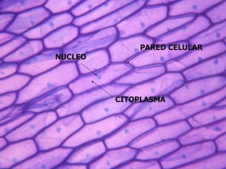 CITOPLASMA PARED CELULAR NUCLEO 