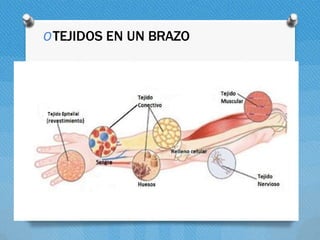 OTEJIDOS EN UN BRAZO
 