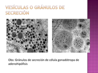 Obs: Gránulos de secreción de célula gonadótropa de
adenohipófisis
 