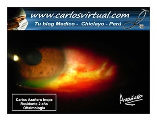 Carlos Azañero Inope
  Residente 2 año
    Oftalmología
 