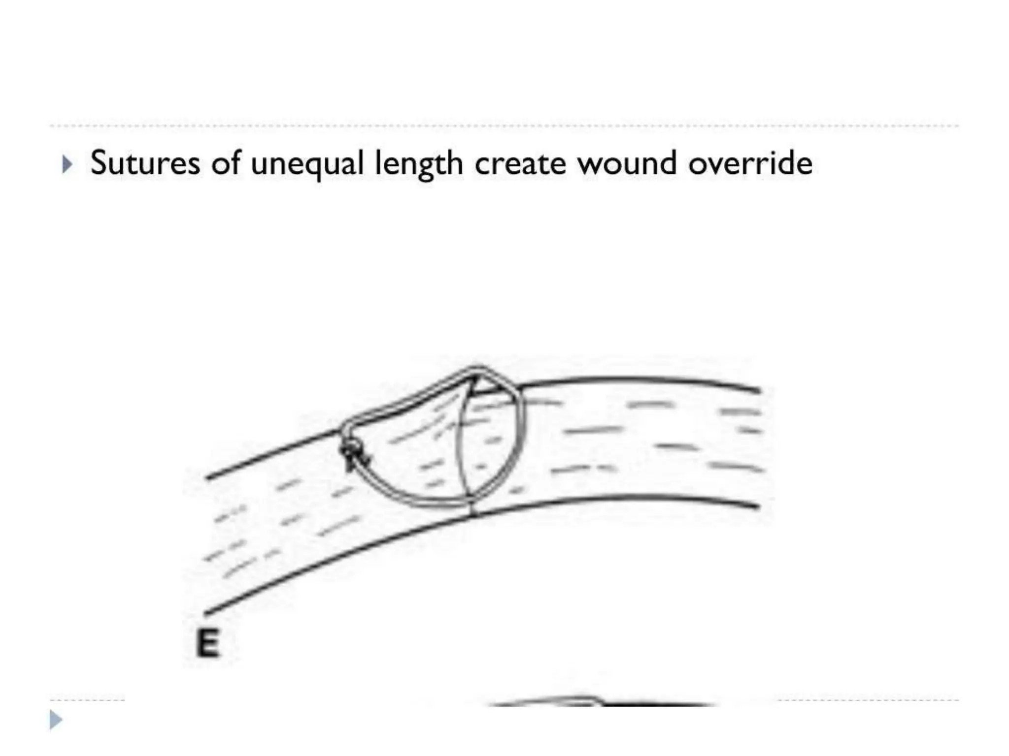 corneal l injury and laceration in eye.pptx