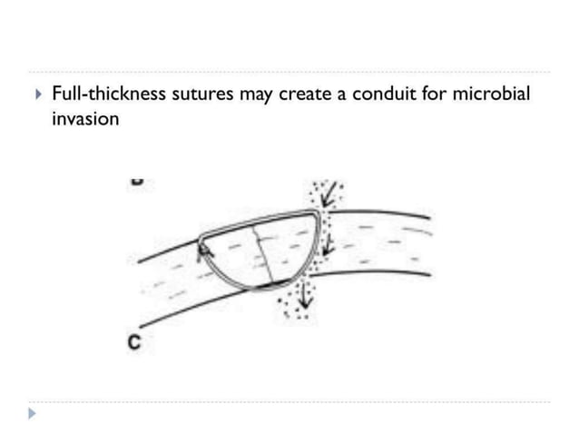 corneal l injury and laceration in eye.pptx