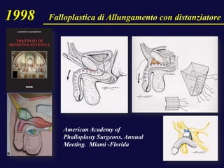 American Academy of
Phalloplasty Surgeons. Annual
Meeting. Miami -Florida
1998 Falloplastica di Allungamento con distanziatore
 