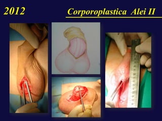 2012 Corporoplastica Alei II
 