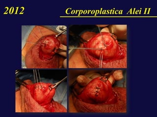 2012 Corporoplastica Alei II
 
