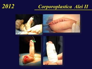 2012 Corporoplastica Alei II
 