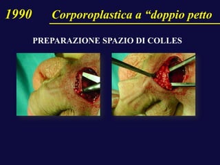 1990 Corporoplastica a “doppio petto
PREPARAZIONE SPAZIO DI COLLES
 