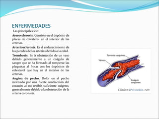 ENFERMEDADES 
Las principales son: 
Aterosclerosis. Consiste en el depósito de 
placas de colesterol en el interior de las 
arterias. 
Arteriosclerosis. Es el endurecimiento de 
las paredes de las arterias debido a la edad. 
Trombosis. Es la obstrucción de un vaso 
debido generalmente a un coágulo de 
sangre que se ha formado al romperse las 
plaquetas al frotar con los depósitos de 
colesterol que hay en el interior de las 
arterias. 
Angina de pecho. Dolor en el pecho 
motivado por una fuerte contracción del 
corazón al no recibir suficiente oxígeno, 
generalmente debido a la obstrucción de la 
arteria coronaria. 
 