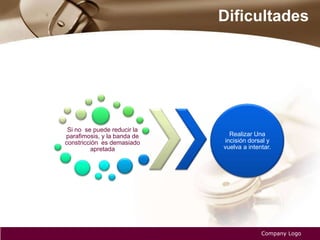 Dificultades
Company Logo
Si no se puede reducir la
parafimosis, y la banda de
constricción es demasiado
apretada
Realizar Una
incisión dorsal y
vuelva a intentar.
 