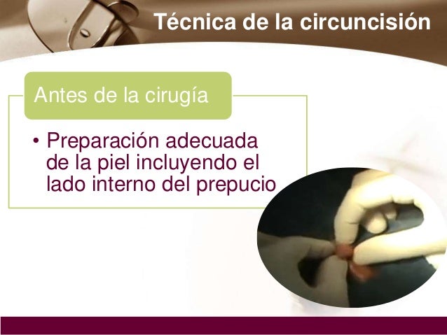 Gratuito aumentará el miembro
