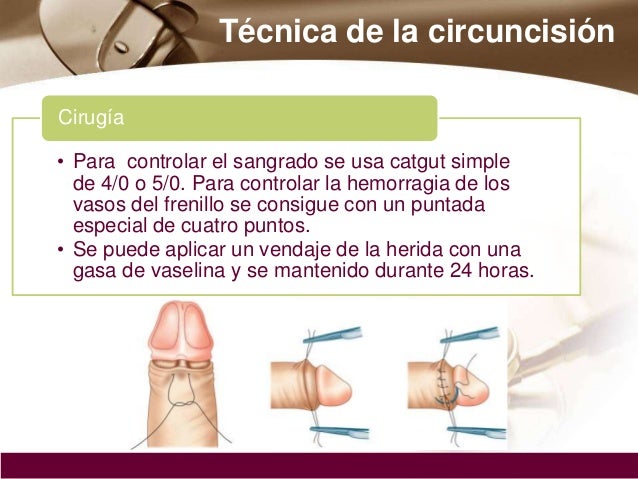 La circuncisión