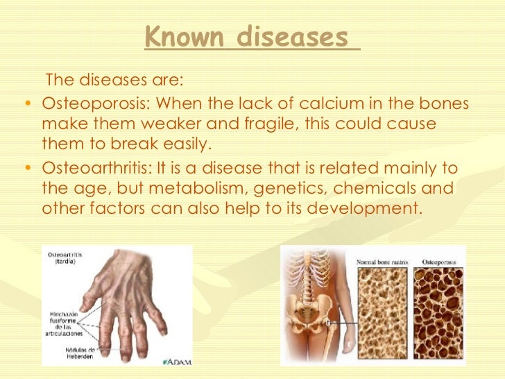 Lack of CalciumSixth A