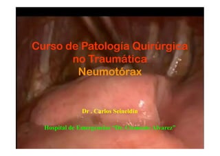 Curso de Patología Quirúrgica
no Traumática
Neumotórax
Dr . Carlos Seineldin
Hospital de Emergencias “Dr. Clemente Alvarez”
 