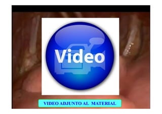 VIDEO ADJUNTO AL MATERIAL
 