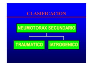 CLASIFICACION
 