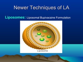 Newer Techniques of LANewer Techniques of LA
Liposomes: Liposomal Bupivacaine Formulation
 
