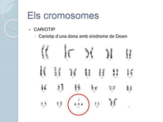 Els cromosomes
 CARIOTIP
◦ Cariotip d’una dona amb síndrome de Down
 