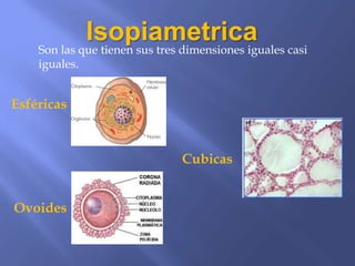 Isopiametrica
    Son las que tienen sus tres dimensiones iguales casi
    iguales.


Esféricas


                               Cubicas


Ovoides
 
