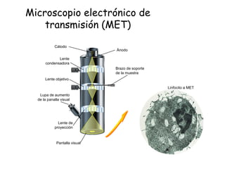 Microscopio electrónico de
transmisión (MET)
Cátodo
Ánodo
Lente
condensadora
Lente objetivo
Lupa de aumento
de la panalla visual
Lente de
proyección
Brazo de soporte
de la muestra
Pantalla visual
Linfocito a MET
 